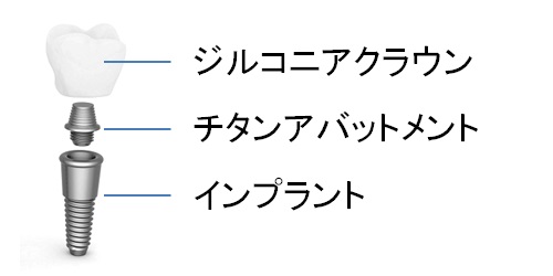 スタンダード